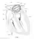 Fig. 02 - Enhanced medical device for use in bodily cavities, for example an atrium