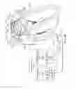 Fig. 13 - Enhanced medical device for use in bodily cavities, for example an atrium
