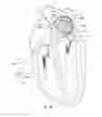 Fig. 27 - Enhanced medical device for use in bodily cavities, for example an atrium