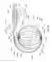 Fig. 31 - Enhanced medical device for use in bodily cavities, for example an atrium