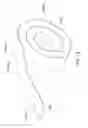 Fig. 45 - Enhanced medical device for use in bodily cavities, for example an atrium