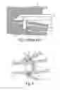 Fig. 03 - Endoscopic vessel harvester with blunt and active dissection