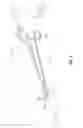 Fig. 02 - Vessel sealing instrument with reduced thermal spread and method of manufacture therefor