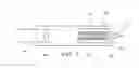 Fig. 03 - Blunt tip surgical cutting device and method