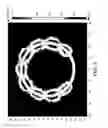 Fig. 05 - Cardiac pulsed field ablation