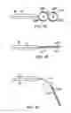 Fig. 08 - Catheter with distal section having side-by-side loops