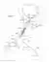 Fig. 04 - Method for treating a tubular anatomical structure