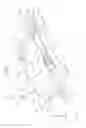 Fig. 05 - Method for treating a tubular anatomical structure