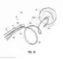 Fig. 03 - Systems and methods for treating the heart with ablation