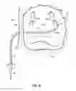 Fig. 06 - Systems and methods for treating the heart with ablation