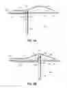 Fig. 08 - Systems and methods for treating the heart with ablation
