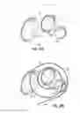 Fig. 11 - Systems and methods for treating the heart with ablation