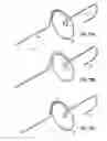 Fig. 15 - Systems and methods for treating the heart with ablation