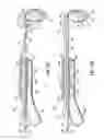 Fig. 18 - Systems and methods for treating the heart with ablation