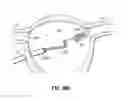 Fig. 25 - Systems and methods for treating the heart with ablation