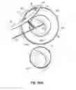 Fig. 30 - Systems and methods for treating the heart with ablation