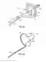 Fig. 35 - Systems and methods for treating the heart with ablation