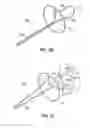 Fig. 37 - Systems and methods for treating the heart with ablation