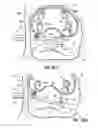 Fig. 40 - Systems and methods for treating the heart with ablation