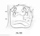 Fig. 41 - Systems and methods for treating the heart with ablation