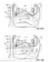 Fig. 43 - Systems and methods for treating the heart with ablation
