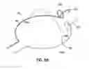 Fig. 51 - Systems and methods for treating the heart with ablation