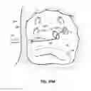 Fig. 52 - Systems and methods for treating the heart with ablation