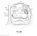 Fig. 56 - Systems and methods for treating the heart with ablation