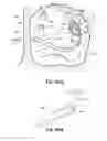Fig. 58 - Systems and methods for treating the heart with ablation