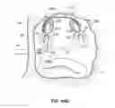 Fig. 68 - Systems and methods for treating the heart with ablation