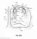 Fig. 69 - Systems and methods for treating the heart with ablation