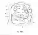 Fig. 70 - Systems and methods for treating the heart with ablation