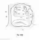 Fig. 71 - Systems and methods for treating the heart with ablation