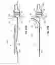 Fig. 75 - Systems and methods for treating the heart with ablation