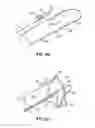 Fig. 78 - Systems and methods for treating the heart with ablation