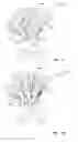Fig. 20 - Inter-operative switching of tools in a robotic surgical system