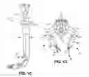 Fig. 03 - Robotic surgical devices, systems, and related methods