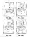 Fig. 41 - Robotic surgical devices, systems, and related methods