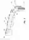 Fig. 03 - Orthodontic retention components, kit and system