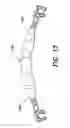 Fig. 14 - Orthodontic retention components, kit and system