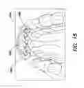 Fig. 16 - Orthodontic retention components, kit and system