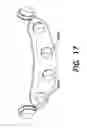 Fig. 18 - Orthodontic retention components, kit and system