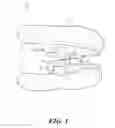 Fig. 02 - Oral apparatuses and methods for mandibular jaw manipulation