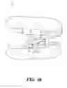 Fig. 11 - Oral apparatuses and methods for mandibular jaw manipulation