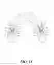 Fig. 12 - Oral apparatuses and methods for mandibular jaw manipulation