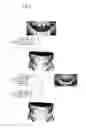 Fig. 04 - METHOD FOR PLANNING DENTAL TREATMENT