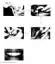 Fig. 06 - METHOD FOR PLANNING DENTAL TREATMENT