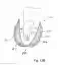 Fig. 12 - CLEANING, DRYING, AND DISPENSING APPLICATOR PAD