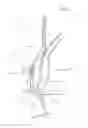 Fig. 02 - Method for producing an artificial anal sphincter and prosthesis thereof
