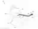 Fig. 01 - Implantable medical device and methods of delivering the implantable medical device